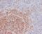 Inositol Polyphosphate-5-Phosphatase D antibody, M03358, Boster Biological Technology, Immunohistochemistry frozen image 