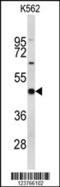 Eukaryotic Translation Initiation Factor 4A2 antibody, MBS9202750, MyBioSource, Western Blot image 