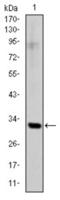 Snail Family Transcriptional Repressor 1 antibody, abx012238, Abbexa, Enzyme Linked Immunosorbent Assay image 