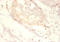Small Nuclear Ribonucleoprotein Polypeptide G antibody, LS-C211132, Lifespan Biosciences, Immunohistochemistry paraffin image 