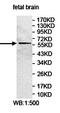 Eukaryotic Translation Initiation Factor 3 Subunit D antibody, orb78259, Biorbyt, Western Blot image 