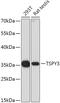 Testis Specific Protein Y-Linked 3 antibody, 18-151, ProSci, Western Blot image 