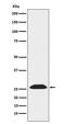 Ubiquitin C-Terminal Hydrolase L3 antibody, M05004-1, Boster Biological Technology, Western Blot image 