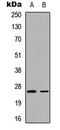 Ubiquitin Domain Containing 2 antibody, LS-C358876, Lifespan Biosciences, Western Blot image 