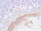 Actin Alpha 2, Smooth Muscle antibody, PA5-32587, Invitrogen Antibodies, Immunohistochemistry frozen image 