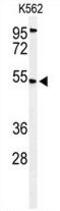 Mitochondrial Calcium Uptake 1 antibody, GTX53535, GeneTex, Western Blot image 