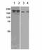 SET Domain Bifurcated Histone Lysine Methyltransferase 1 antibody, ab12317, Abcam, Western Blot image 