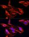 Matrix Metallopeptidase 2 antibody, LS-C746891, Lifespan Biosciences, Immunofluorescence image 