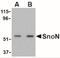 Ski-like protein antibody, NBP1-77306, Novus Biologicals, Western Blot image 