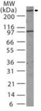 Mediator of DNA damage checkpoint protein 1 antibody, GTX13858, GeneTex, Western Blot image 