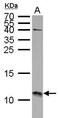 S100 Calcium Binding Protein A11 antibody, PA5-21330, Invitrogen Antibodies, Western Blot image 