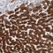 Cytochrome P450 Family 2 Subfamily E Member 1 antibody, NBP1-85366, Novus Biologicals, Immunohistochemistry paraffin image 