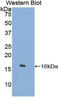 Tryptase Delta 1 antibody, LS-C296830, Lifespan Biosciences, Western Blot image 