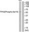 Tryptophan Hydroxylase 2 antibody, TA316055, Origene, Western Blot image 