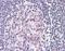Collagen Type V Alpha 1 Chain antibody, orb86617, Biorbyt, Immunohistochemistry paraffin image 