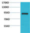 Signal Transducer And Activator Of Transcription 4 antibody, STJ97472, St John