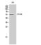 Cytochrome P450 Family 2 Subfamily B Member 6 antibody, STJ92573, St John