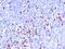 Immunoglobulin Heavy Constant Gamma 1 (G1m Marker) antibody, MBS438254, MyBioSource, Immunohistochemistry frozen image 