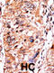 Cyclin-dependent kinase inhibitor 2A, isoforms 1/2/3 antibody, abx031883, Abbexa, Immunohistochemistry frozen image 