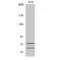 Lamin A/C antibody, LS-C384329, Lifespan Biosciences, Western Blot image 
