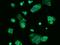 40S ribosomal protein S10 antibody, GTX02198, GeneTex, Immunofluorescence image 