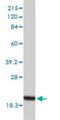 RNA polymerase II RBP8 antibody, H00005437-M01, Novus Biologicals, Western Blot image 