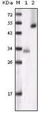 Glycogen Synthase Kinase 3 Alpha antibody, GTX83071, GeneTex, Western Blot image 