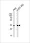 TATA-Box Binding Protein Associated Factor 8 antibody, 57-029, ProSci, Western Blot image 