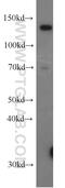 Ubiquitin Specific Peptidase 28 antibody, 17707-1-AP, Proteintech Group, Western Blot image 