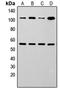 Nuclear Factor Kappa B Subunit 1 antibody, LS-C358829, Lifespan Biosciences, Western Blot image 