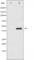 SMAD Family Member 3 antibody, abx011535, Abbexa, Western Blot image 