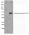 Potassium Voltage-Gated Channel Subfamily C Member 2 antibody, LS-C415939, Lifespan Biosciences, Western Blot image 