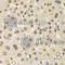 Cullin 4B antibody, A5400, ABclonal Technology, Immunohistochemistry paraffin image 