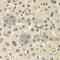 Cullin-4B antibody, A5400, ABclonal Technology, Immunohistochemistry paraffin image 