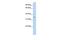 Tenomodulin antibody, GTX46023, GeneTex, Western Blot image 