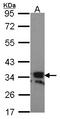 TNF Superfamily Member 11 antibody, LS-C185996, Lifespan Biosciences, Western Blot image 