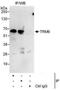 TRNA Methyltransferase 6 antibody, NBP1-50039, Novus Biologicals, Immunoprecipitation image 