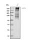 Collagen Type VII Alpha 1 Chain antibody, A01170-1, Boster Biological Technology, Western Blot image 