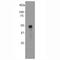 Arrestin Beta 1 antibody, M03775, Boster Biological Technology, Western Blot image 