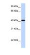Iroquois Homeobox 6 antibody, NBP1-79257, Novus Biologicals, Western Blot image 
