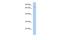 Hexosaminidase D antibody, A13243, Boster Biological Technology, Western Blot image 