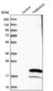 Transmembrane Protein 243 antibody, PA5-53256, Invitrogen Antibodies, Western Blot image 