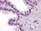 Androgen Receptor antibody, NBP1-47471, Novus Biologicals, Immunohistochemistry paraffin image 