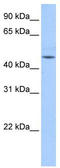 Zinc Finger Protein 829 antibody, TA339656, Origene, Western Blot image 