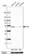 Eukaryotic Translation Initiation Factor 3 Subunit E antibody, NBP1-84869, Novus Biologicals, Western Blot image 