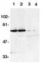 TNF Receptor Superfamily Member 21 antibody, LS-C320, Lifespan Biosciences, Western Blot image 