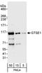 G2 And S-Phase Expressed 1 antibody, A302-425A, Bethyl Labs, Western Blot image 