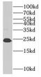 RAB8B, Member RAS Oncogene Family antibody, FNab07047, FineTest, Western Blot image 