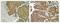 Protein Tyrosine Kinase 2 Beta antibody, 700183, Invitrogen Antibodies, Immunohistochemistry paraffin image 