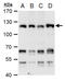 ALC1 antibody, GTX129527, GeneTex, Western Blot image 